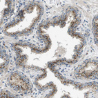 Immunohistochemical staining of human prostate shows strong granular cytoplasmic positivity in glandular cells.