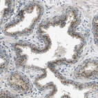 Immunohistochemical staining of human prostate shows strong granular cytoplasmic positivity in glandular cells.