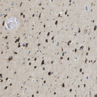Immunohistochemical staining of human cerebral cortex shows strong granular cytoplasmic positivity in neurons.