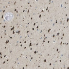 Immunohistochemical staining of human cerebral cortex shows strong granular cytoplasmic positivity in neurons.