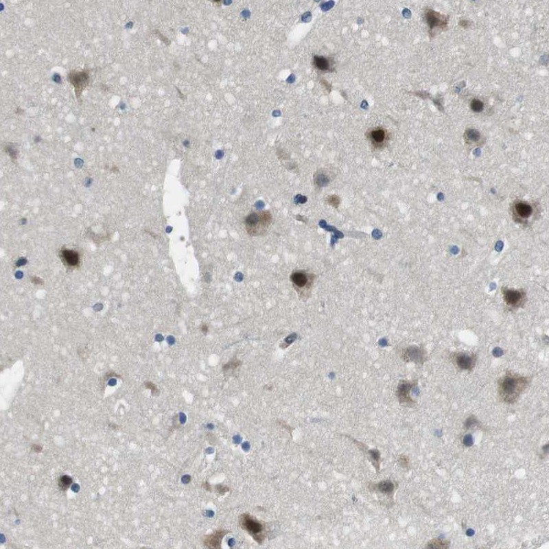 Anti-LRRC49 Antibody