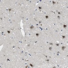 Anti-LRRC49 Antibody