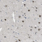 Anti-LRRC49 Antibody