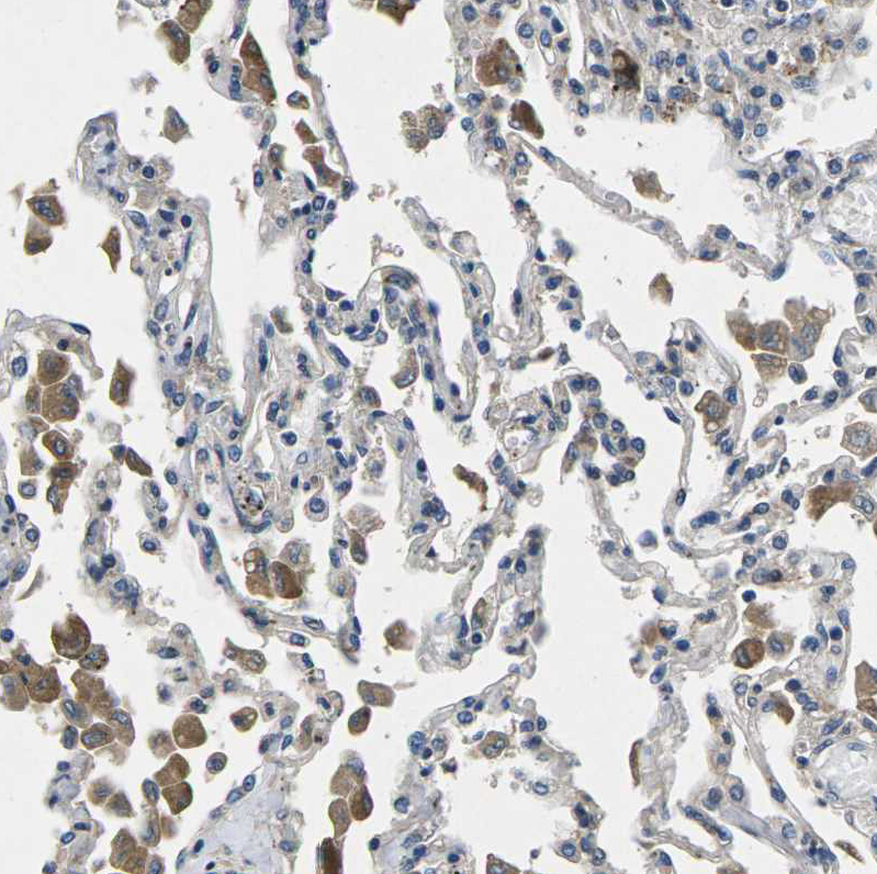 Anti-PLCE1 Antibody