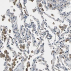 Anti-PLCE1 Antibody