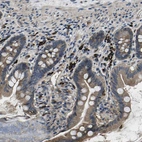 Immunohistochemical staining of small intestine shows moderate cytoplasmic positivity in glandular cells.