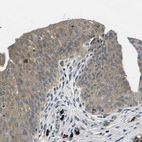 Immunohistochemical staining of human urinary bladder shows moderate cytoplasmic positivity in urothelial cells.