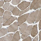 Immunohistochemical staining of human skeletal muscle shows moderate cytoplasmic positivity in myocytes.
