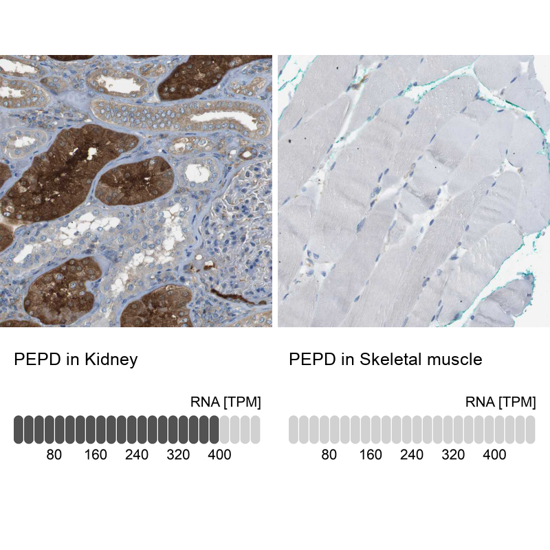 Anti-PEPD Antibody