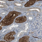 Immunohistochemical staining of human kidney shows strong cytoplasmic positivity in cells in tubules.