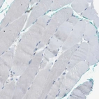 Immunohistochemical staining of human skeletal muscle shows no positivity in myocytes as expected.