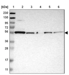 Lane 1: Marker [kDa] 230, 130, 95, 72, 56, 36, 28, 17, 11_br/_Lane 2: Human cell line RT-4_br/_Lane 3: Human cell line U-251MG sp_br/_Lane 4: Human plasma (IgG/HSA depleted)_br/_Lane 5: Human liver tissue_br/_Lane 6: Human tonsil tissue