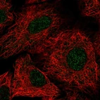 Immunofluorescent staining of human cell line A549 shows localization to nucleoplasm.