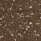 Immunohistochemical staining of human cerebral cortex shows high expression.