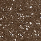 Immunohistochemical staining of human cerebral cortex shows high expression.