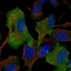 Immunofluorescent staining of human cell line SH-SY5Y shows localization to plasma membrane.