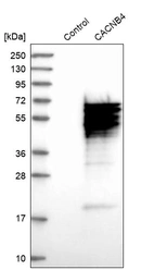 Western blot analysis in control (vector only transfected HEK293T lysate) and CACNB4 over-expression lysate (Co-expressed with a C-terminal myc-DDK tag (~3.1 kDa) in mammalian HEK293T cells, LY400240).