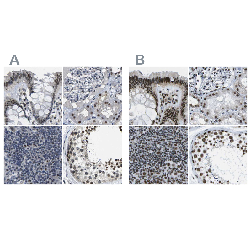Anti-NSRP1 Antibody