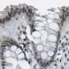 Immunohistochemical staining of human colon using Anti-NSRP1 antibody HPA015603.