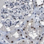 Immunohistochemical staining of human kidney using Anti-NSRP1 antibody HPA015603.