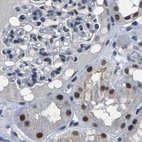 Anti-NSRP1 Antibody
