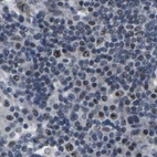 Immunohistochemical staining of human lymph node using Anti-NSRP1 antibody HPA015603.