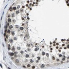 Immunohistochemical staining of human testis using Anti-NSRP1 antibody HPA015603.
