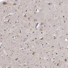 Immunohistochemical staining of human cerebral cortex shows high expression.