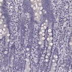 Immunohistochemical staining of human duodenum shows low expression as expected.