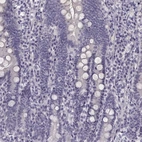 Immunohistochemical staining of human duodenum shows low expression as expected.