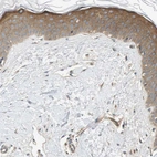 Immunohistochemical staining of human skin shows strong cytoplasmic positivity in squamous epithelial cells.