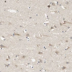 Immunohistochemical staining of human cerebral cortex shows weak cytoplasmic positivity in neurons.