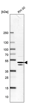 Western blot analysis in human cell line RH-30.