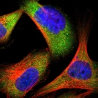 Immunofluorescent staining of human cell line U-251 MG shows localization to cytosol.