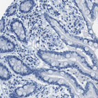 Immunohistochemical staining of human colon shows no positivity in glandular cells as expected.