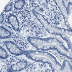 Immunohistochemical staining of human colon shows no positivity in glandular cells as expected.