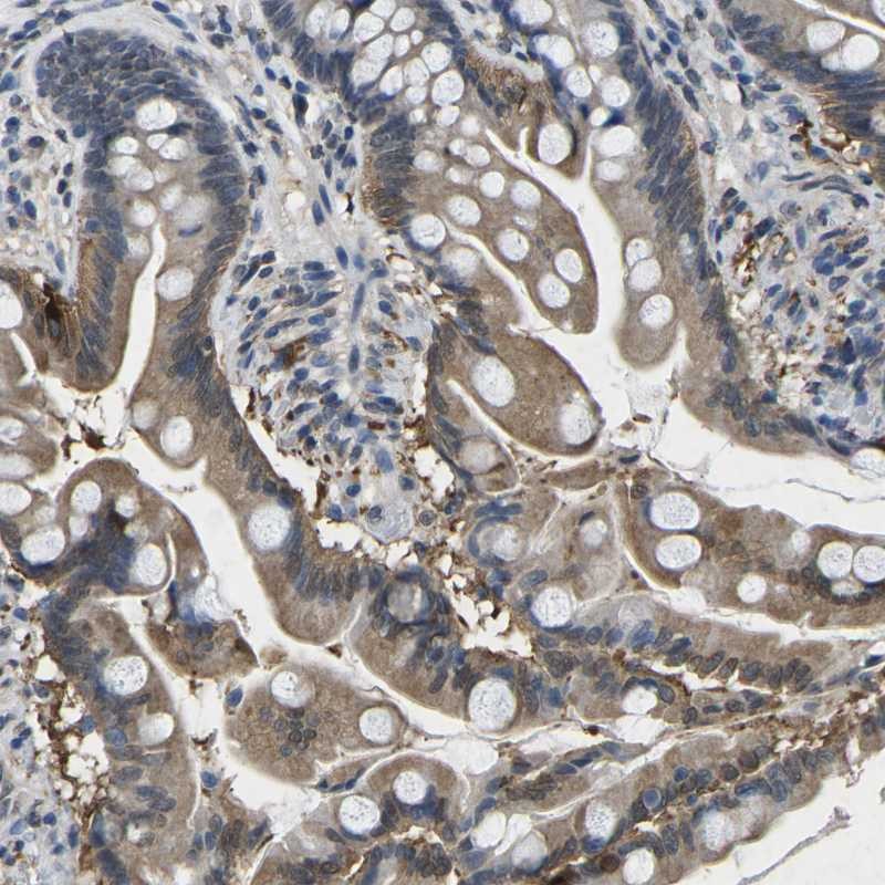 Rabbit Polyclonal AntiSCNN1B Antibody Buy for research Highly