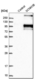 Anti-SCNN1B Antibody