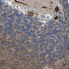 Anti-KIAA1551 Antibody