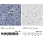 Anti-GZMM Antibody