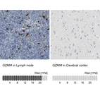 Anti-GZMM Antibody