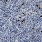 Anti-GZMM Antibody