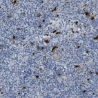 Immunohistochemical staining of human lymph node shows high expression.