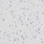 Immunohistochemical staining of human cerebral cortex shows low expression as expected.