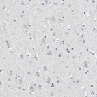 Immunohistochemical staining of human cerebral cortex shows low expression as expected.