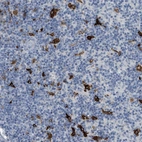 Anti-TIMD4 Antibody