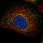 Immunofluorescent staining of human cell line A-431 shows localization to cytosol.