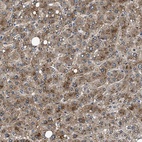 Anti-NEU1 Antibody