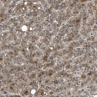 Anti-NEU1 Antibody