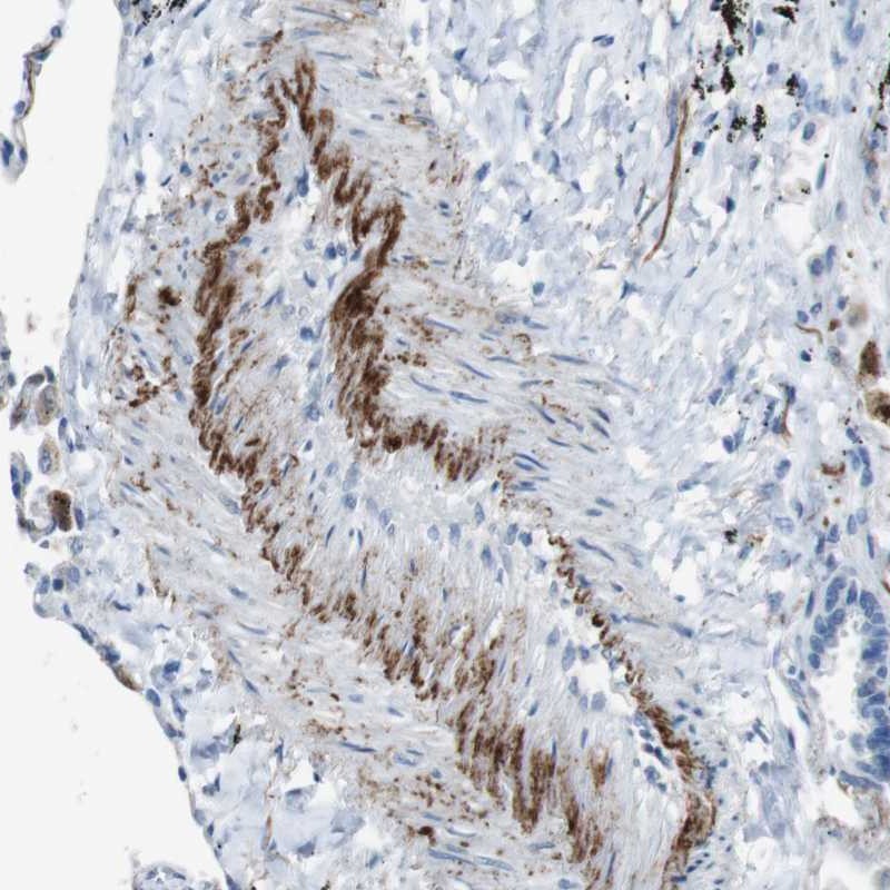 Anti-APOBEC4 Antibody